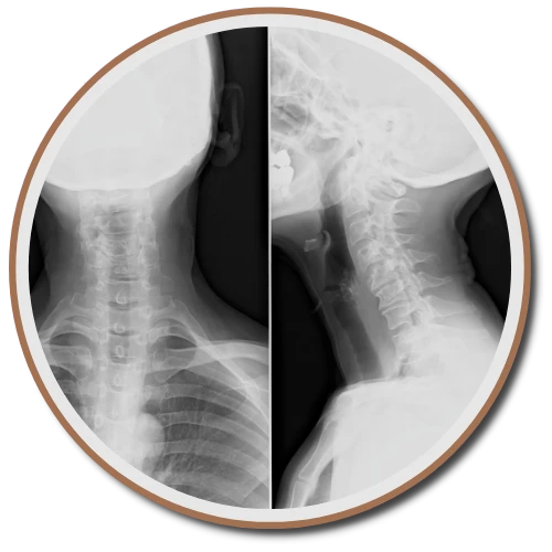 5 Components Of The Gonstead Technique | Chiropractor